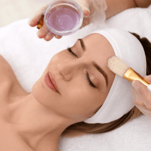 Chemical-peels