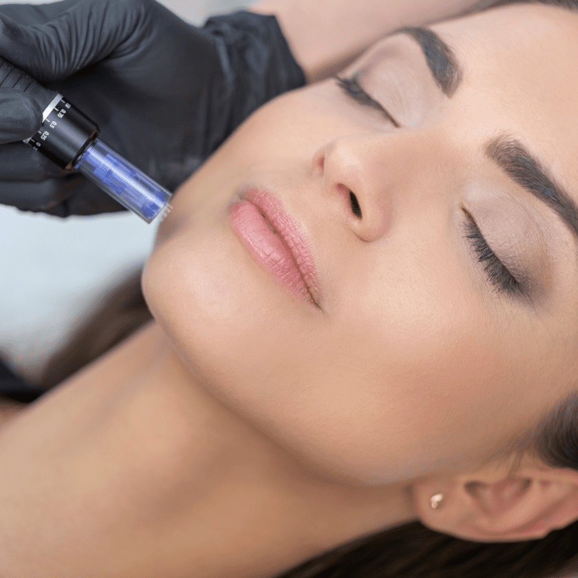 Micro-dermal-needling